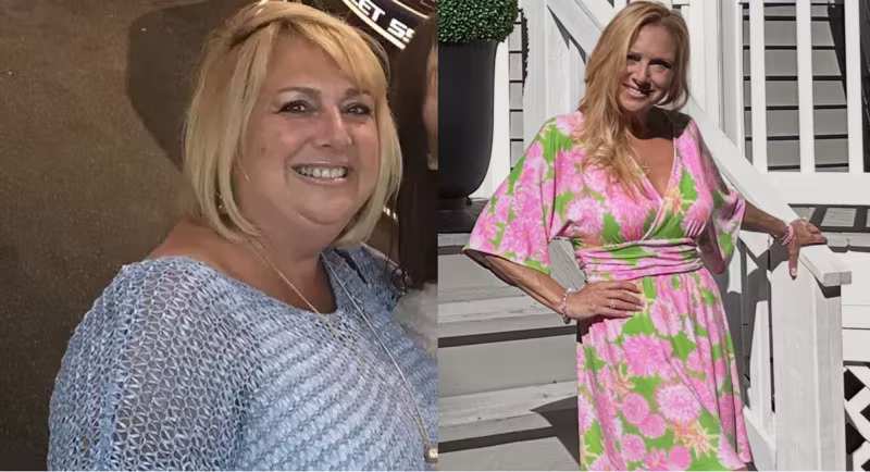 Before and after photo of Yucca Health GLP-1 patient Lisa C., who lost 75 lbs in 10 months.